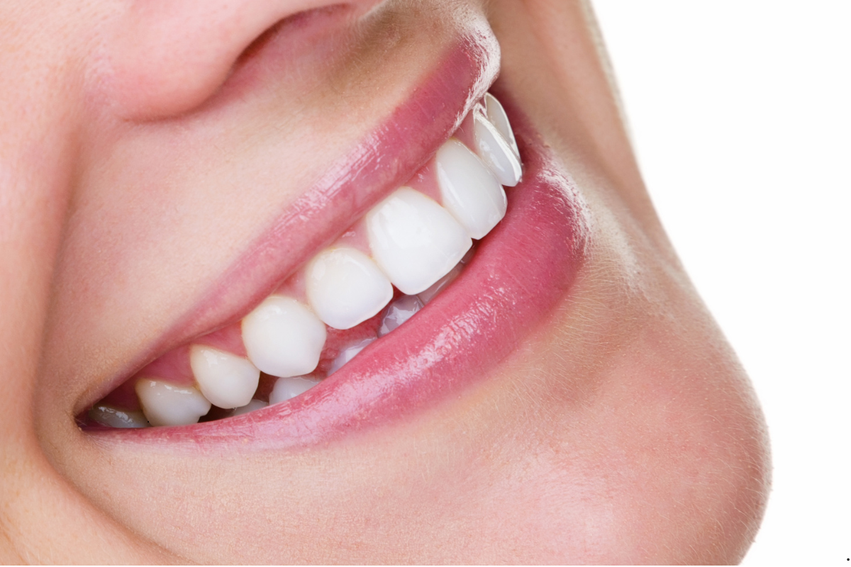 Woman displaying bright, naturally white teeth with healthy pink gums and lips in a genuine smile.